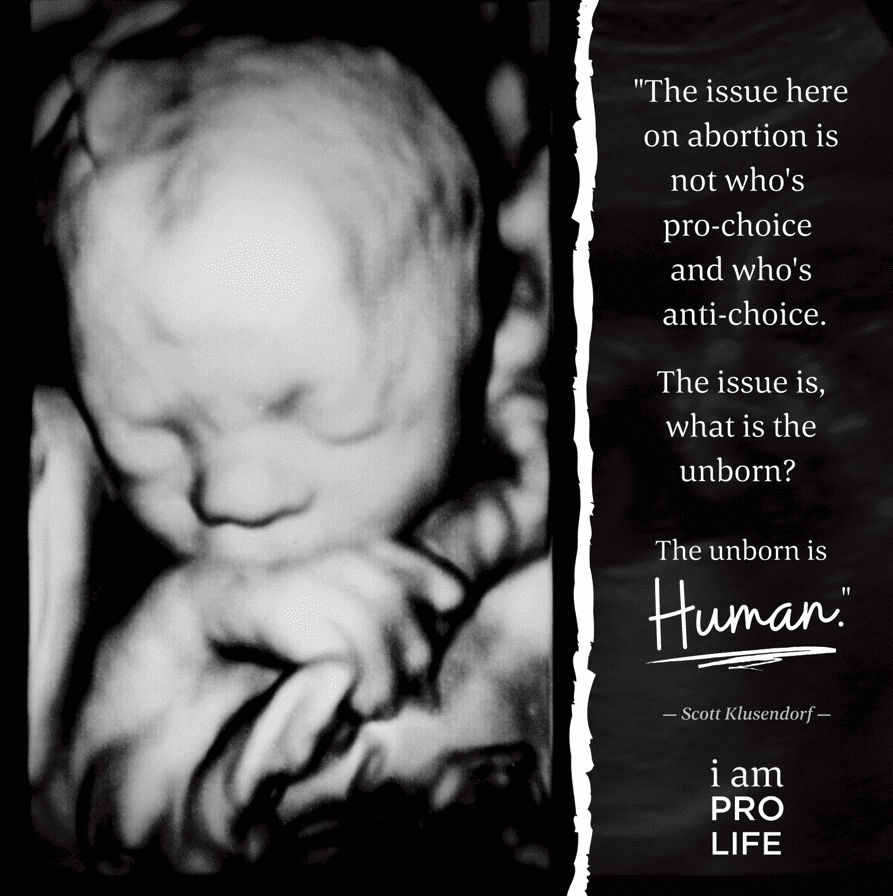 An image of a 3D ultrasound in black next to a quote from Scott Klusendorf on abortion history and the preborn human baby.