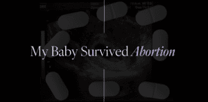 My baby survived abortion in my failed abortion.